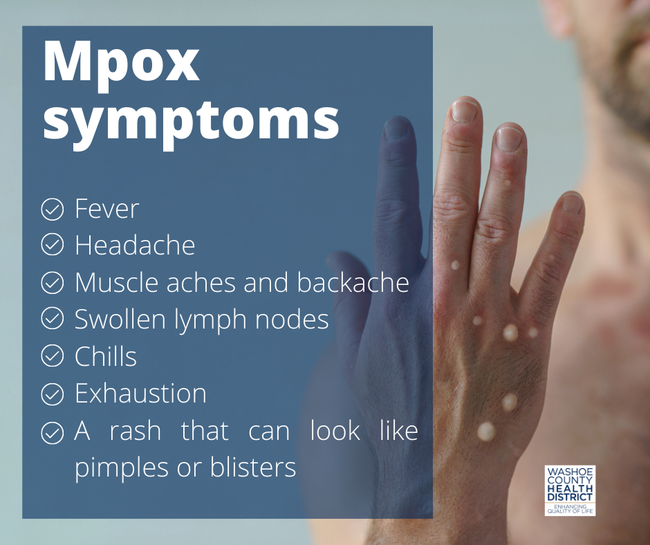 Mpox Virus: Gejala, Penyebab, dan Pencegahan